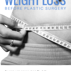 Weight Loss Before Plastic Surgery Featured Article